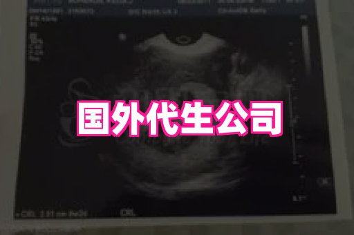 长春助孕网 4